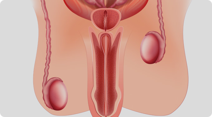 ¿Qué es la criptorquidia?