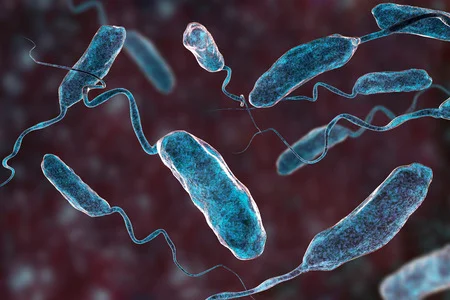 ¿Qué es el cólera?