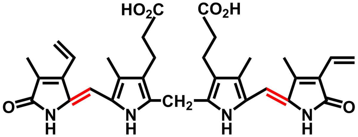 ¿De dónde proviene la bilirrubina?