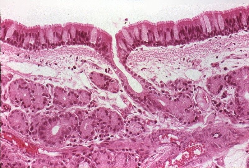 ¿Qué es secreción?