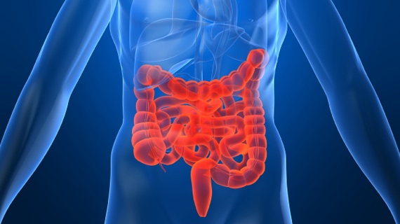 Factores genéticos y ambientales causantes de enfermedad de Crohn