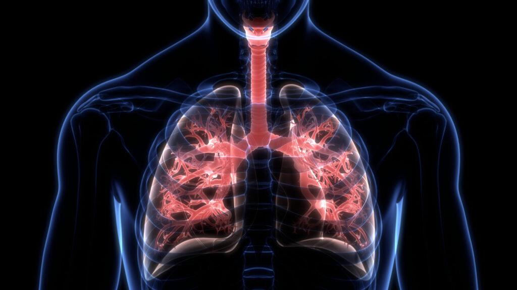 ¿Qué es la fibrosis quística?