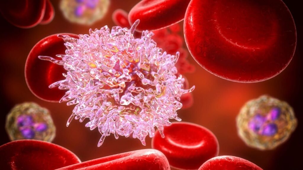 Respuesta Inflamatoria Sistémica