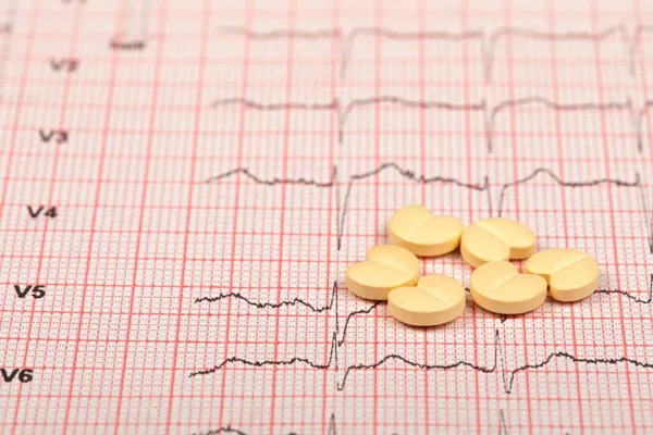 ¿Qué son los medicamentos antiarrítmicos?