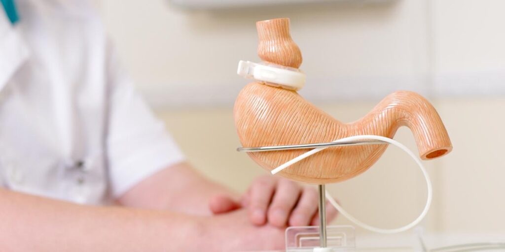 ¿Cómo saber qué pacientes que son candidatos a cirugía bariátrica?