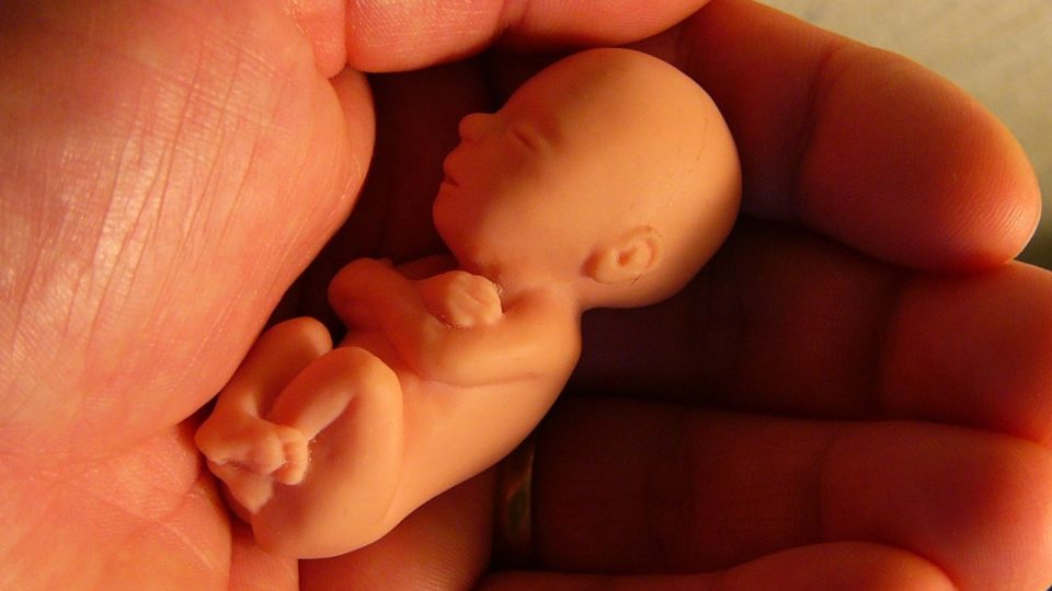 Aborto. Repaso rápido de conceptos