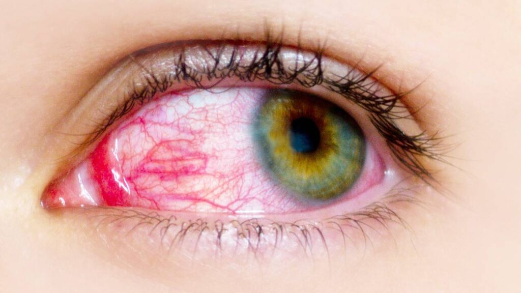 ¿Cuáles son las causas de dolor o enrojecimiento ocular?