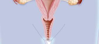 Histología de la vagina