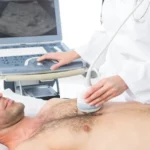 ¿Cuáles son los criterios ecocardiográficos para el diagnostico de fiebre reumática?