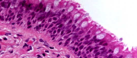 Participación de las células epiteliales en las defensas del organismo.