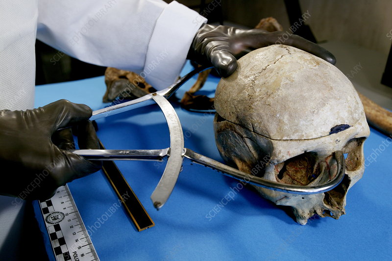 ¿Cuáles son los puntos craneométricos?