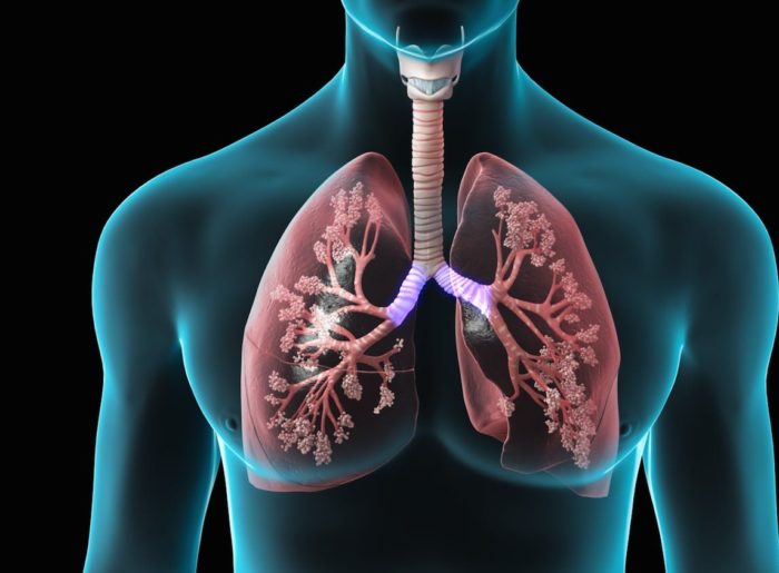 Clasificación de la Hipertensión Pulmonar