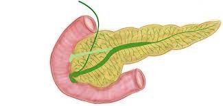 ¿Qué son las neoplasias mucinosas papilares intraductales del páncreas?
