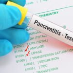 estudios auxiliares útiles en el diagnóstico de pancreatitis aguda