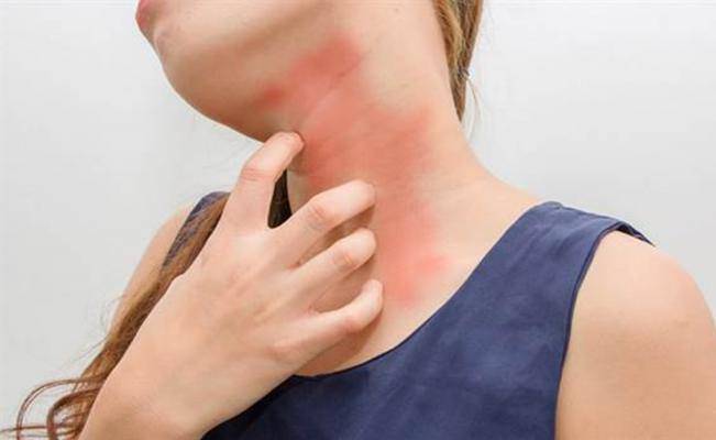 Abordaje urgente de pacientes con anafilaxis y reacciones alérgicas agudas.