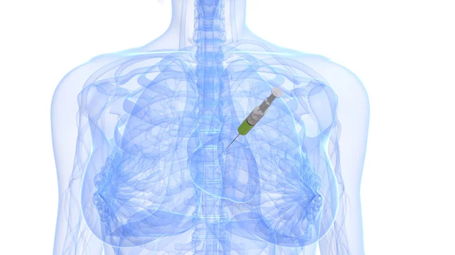 ¿Qué es la pericardiocentésis?