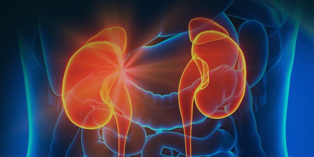 ¿Qué es la pielonefritis aguda?