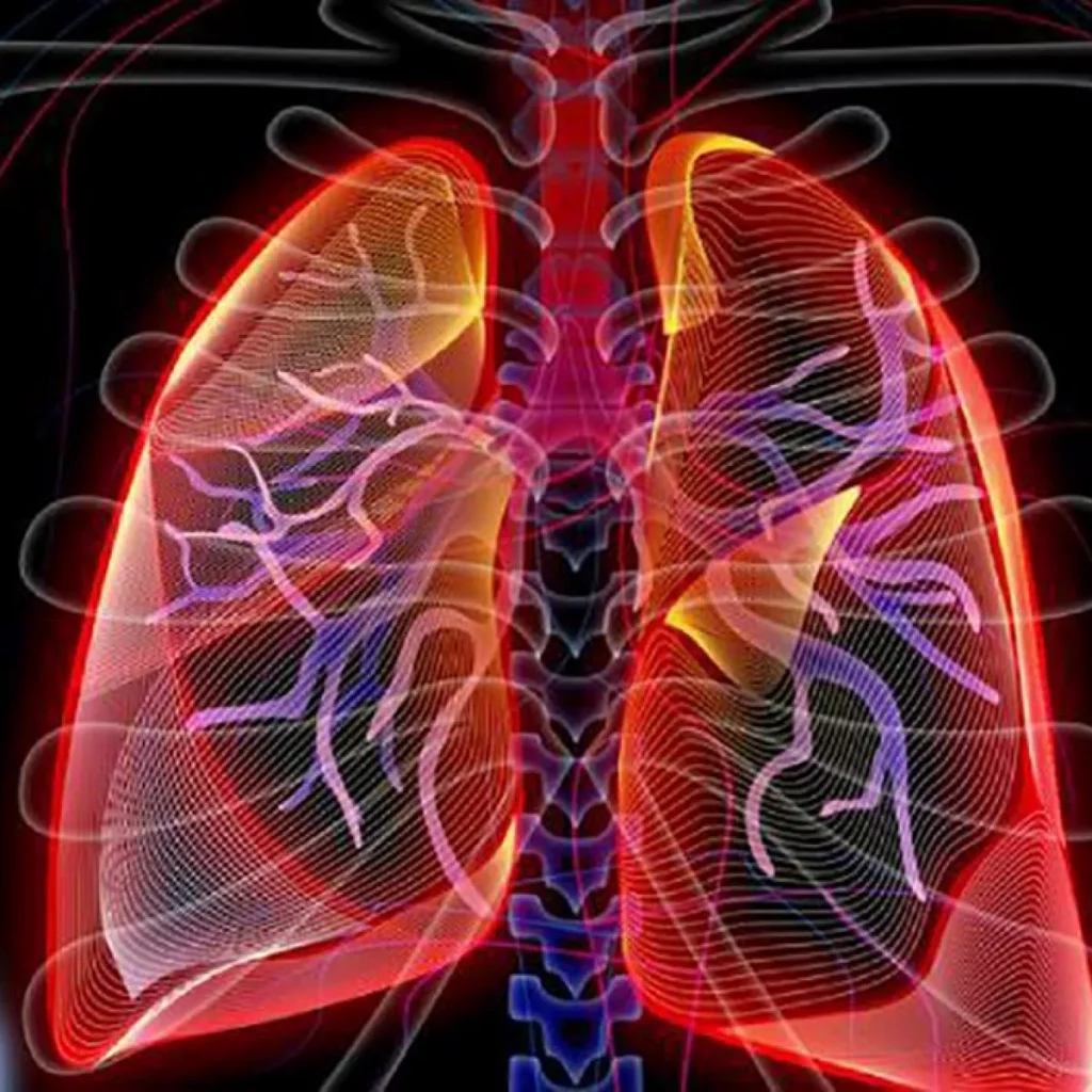 ¿Qué es la hipertensión pulmonar?