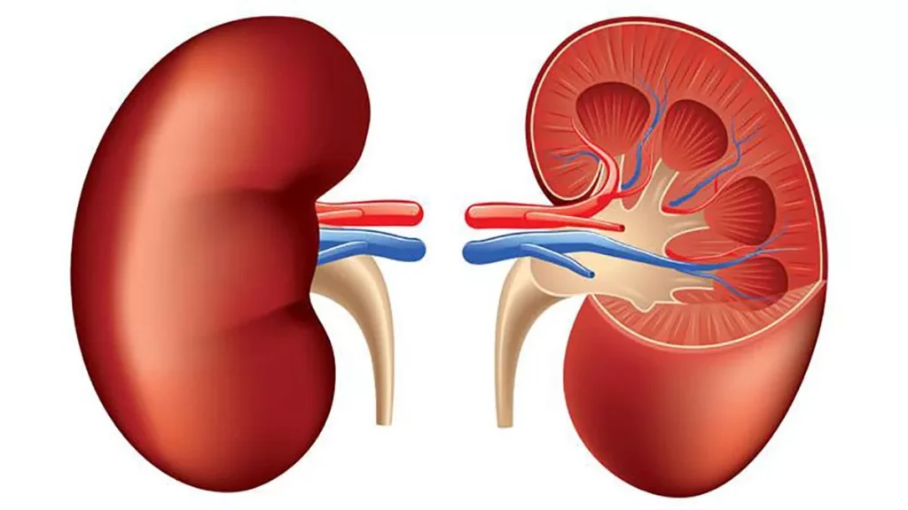 ¿Qué es la espongiosis medular del riñón?