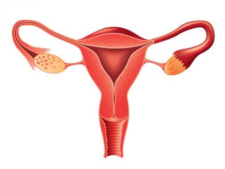 Hemorragia uterina anormal en pacientes premenopáusicas