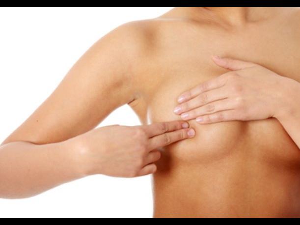 ¿Qué son los trastornos fibroquísticos mamarios?