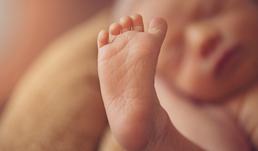 ¿Qué valor de bilirrubina provoca ictericia en el neonato?