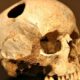 ¿Por que se hacían trepanaciones en la antigüedad?