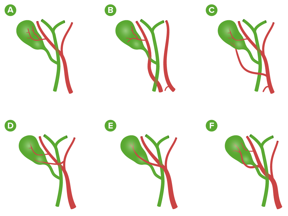 ¿Cuál es la arteria cística?