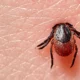 ¿Qué causa la enfermedad de Lyme?