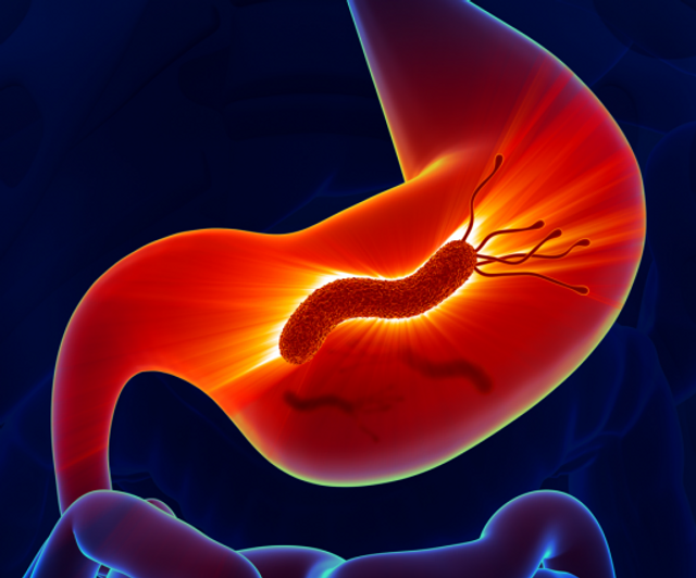 ¿Cuáles son las causas de cáncer gástrico?