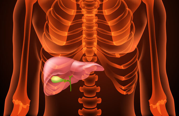 ¿Qué es la colangitis aguda?