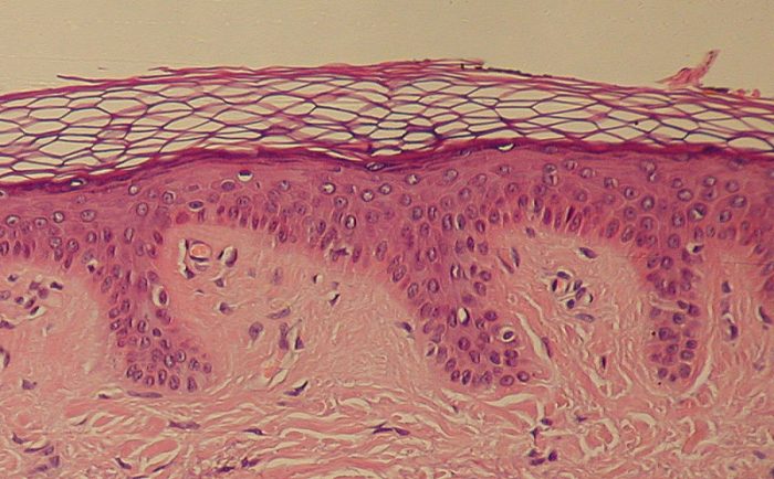 ¿Qué es la dermis?