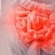 ¿Cuáles son las enfermedades intestinales inflamatorias?