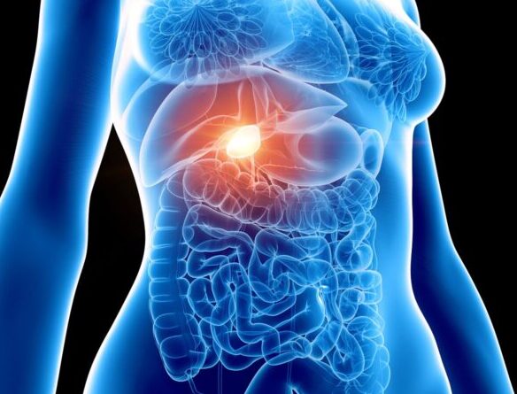 ¿Qué son las fístulas biliodigestivas?