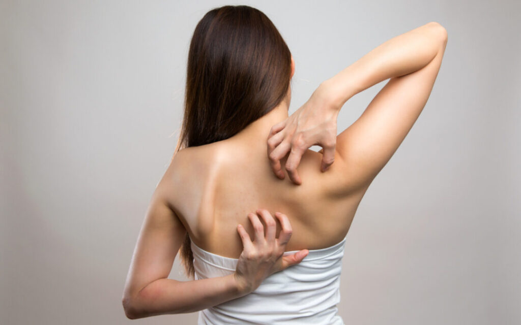 ¿Qué es la notalgia parestésica?