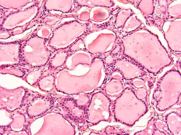 ¿Dónde se almacenan las hormonas tiroideas?