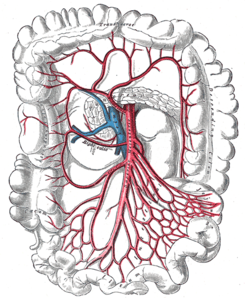 ¿Qué es la insuficiencia arterial visceral?