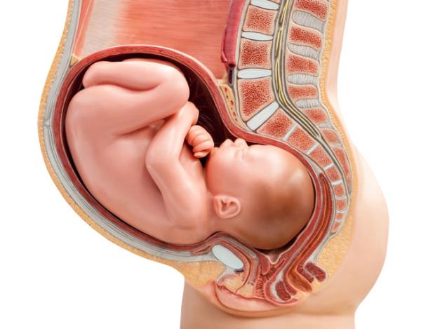 ¿Cuáles son causas de desproporción cefalopélvica?