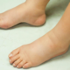 Edema de miembros inferiores
