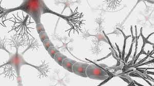 ¿Qué es la neuropatía periférica?