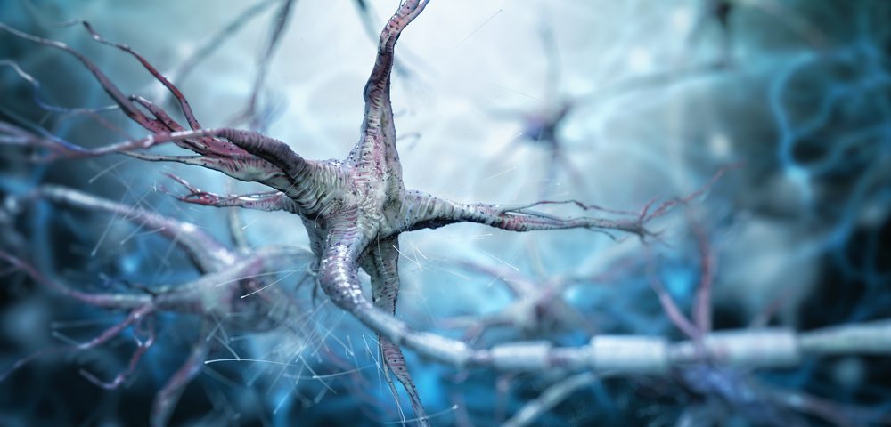 Alteraciones en los nervios en la neuropatía diabética