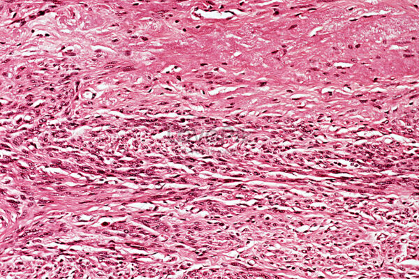 ¿Qué es el acoplamiento electromecánico del miometrio?