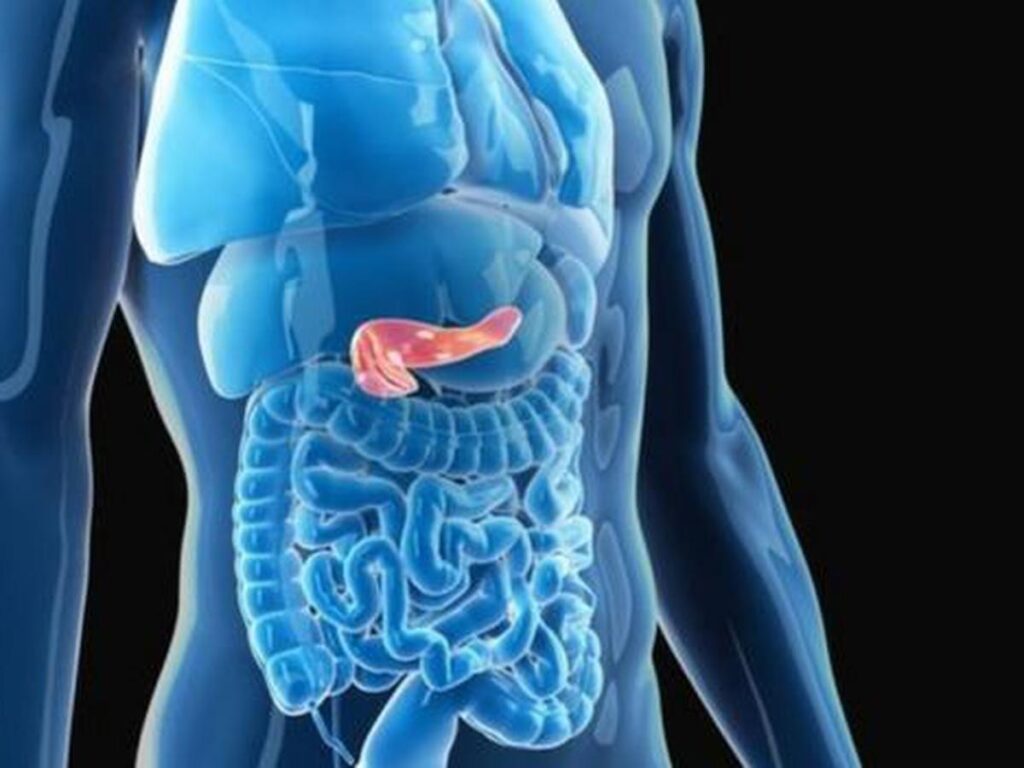 ¿Cuáles son las causas genéticas de pancreatitis crónica?