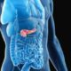 ¿Cuáles son las causas genéticas de pancreatitis crónica?