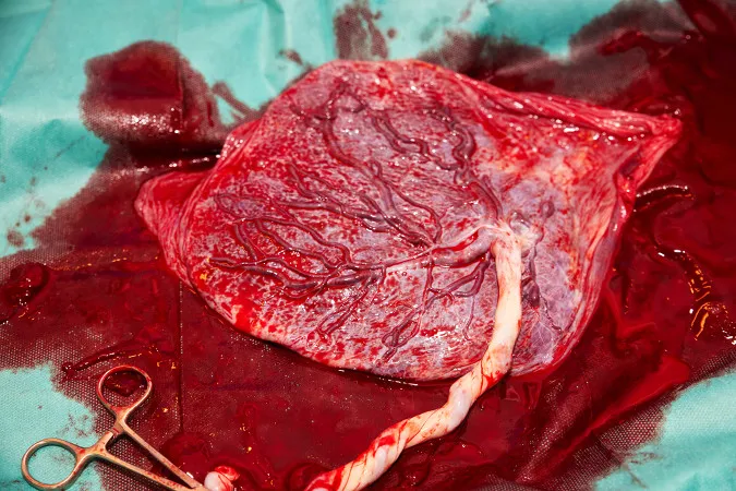 Características principales de la etapa 3 del parto activo