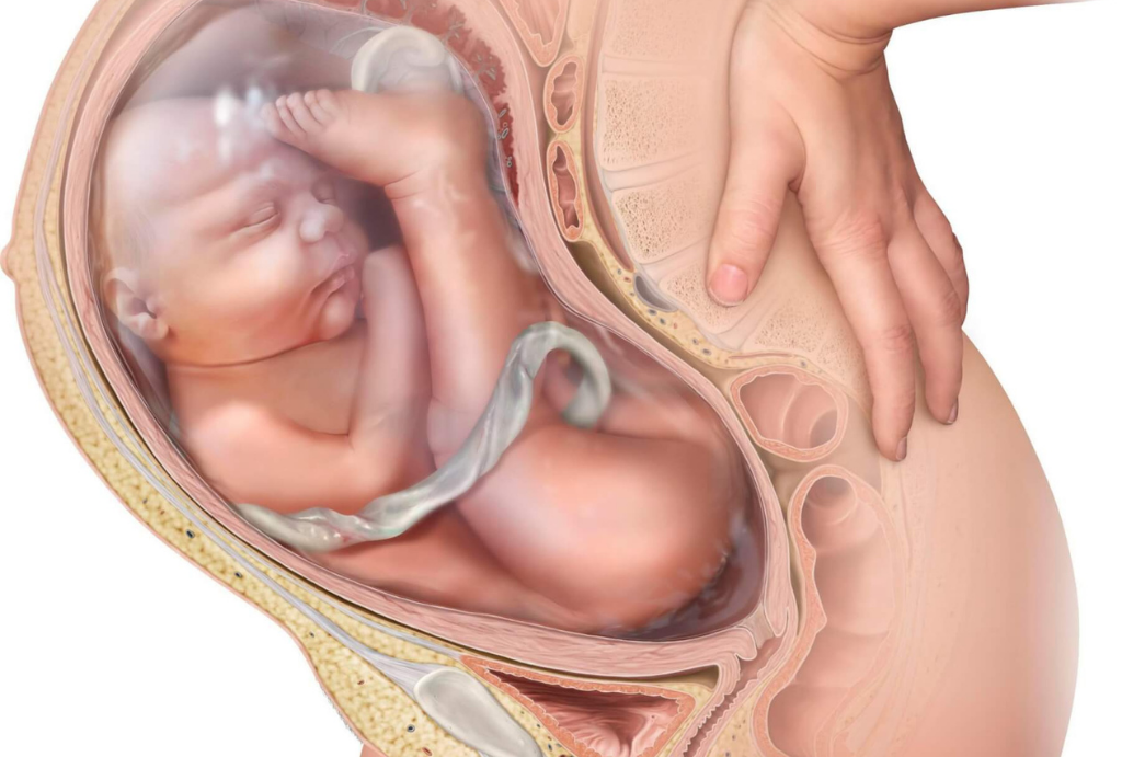 ¿Qué es una presentación fetal pelviana?