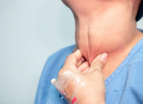 Trastorno por deficiencia de yodo y bocio endémico