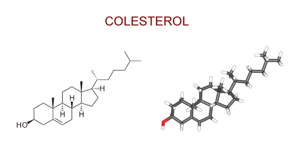 Papel del colesterol en la formación de cálculos biliares