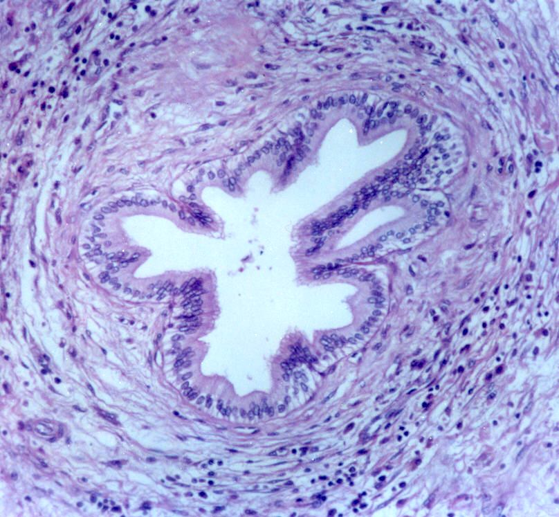 ¿Cómo es el revestimiento del árbol biliar?