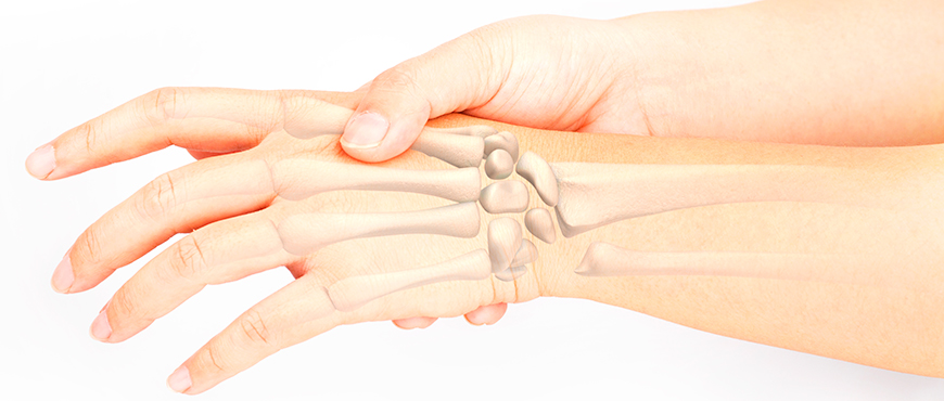 ¿Cuáles son los huesos del metacarpo?